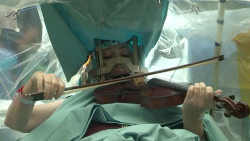 Violinist plays Mozart during brain surgery to conquer 20-year hand tremor (VIDEO) — RT News