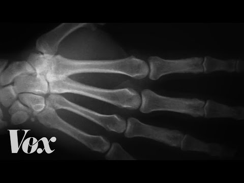 Here’s what happens to your knuckles when you crack them – YouTube