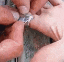 How to remove a stuck ring