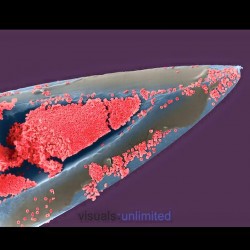 Hypodermic Needle with Blood under microscope.
