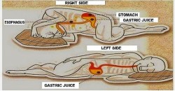 Viral Alternative News: This Is Why Sleeping On Your Left Side Is Good For Your Health