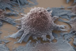 Starving Cancer Cells Of Sugar Could Be The Key To Future Treatment | IFLScience