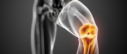 A New “Shock Absorber” for Knees Has Just Been Developed – Futurism