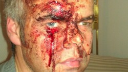 Norway: Oslo Police: “We Have Lost the City” « National Vanguard