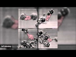 Video Shows How Cancer Cells Form Tumor – YouTube