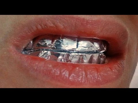 Do You Know What Will Happen If You Wrap Your Teeth With Aluminum Foil For 1 Hour? – YouTube