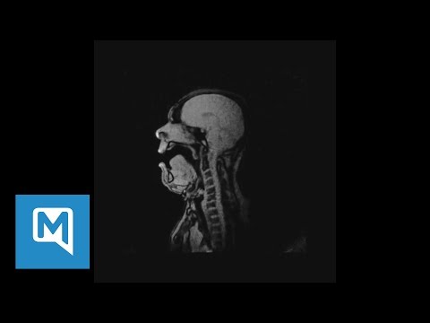 Looking Inside an Opera Singer’s Head With an MRI Is So Freaky