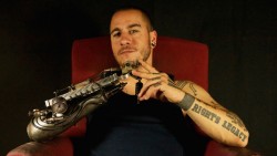 You’ve gotta see these human cyborgs (WARNING: GRAPHIC IMAGES)