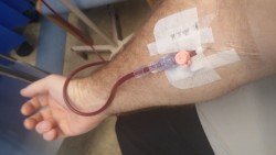 Transfusion