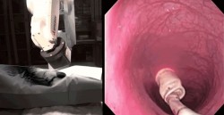 Doctors Have Built a Magnetic Robot to Gently Explore Your Colon
