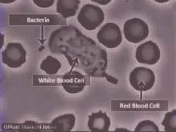 White blood cells help us fight off infections and diseases by literally chasing down and attack ...
