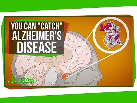 You Can “Catch” Alzheimer’s Disease – YouTube