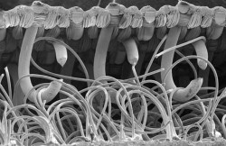 30 Of the Most Amazing Images from Electron Microscopes