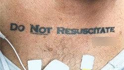 Unconscious Patient With ‘Do Not Resuscitate’ Tattoo Causes Ethical Conundrum at Hos ...