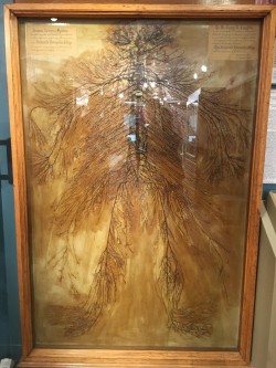 This is an intact human nervous system that was dissected by 2 medical students in 1925. It took ...