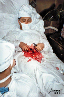 Leonid Rogozov cutting out his own appendix – 30 April 1961