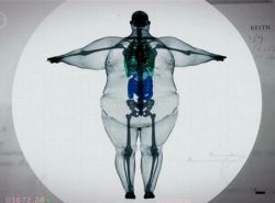 X Ray of a 320Kg  man
