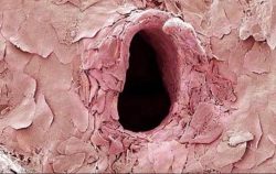 Your skin after penetrated by a needle