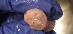 TIL: the umbilical cord has one vein that feeds babies with the nutrients they need from their m ...