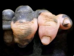 🔥 A gorilla hand with Vitiligo.
