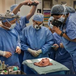 Pre face transplant operation