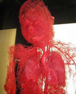 The human body stripped of fat, muscle and bone tissue, with just the vasculature preserved and  ...
