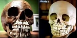 Toddler skulls are full of teeth