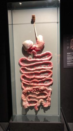 Entire GI tract, digestive system, seen at the Body Worlds exhibit at the Museum of Science Bost ...