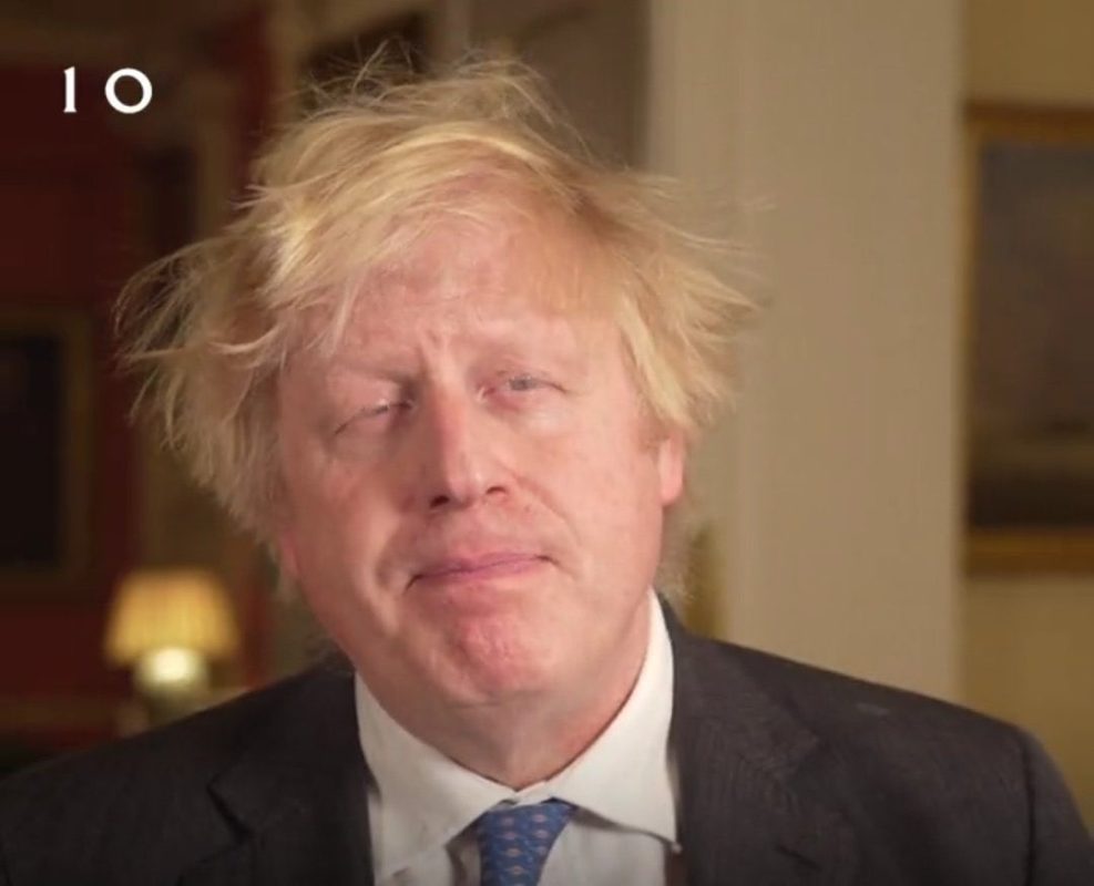 What a fucking mess, just like the moronic UK electorate, this is the face of the UK in 2021