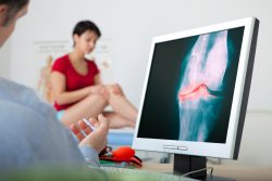 Steroid injections for knee pain linked to worse osteoarthritis progression