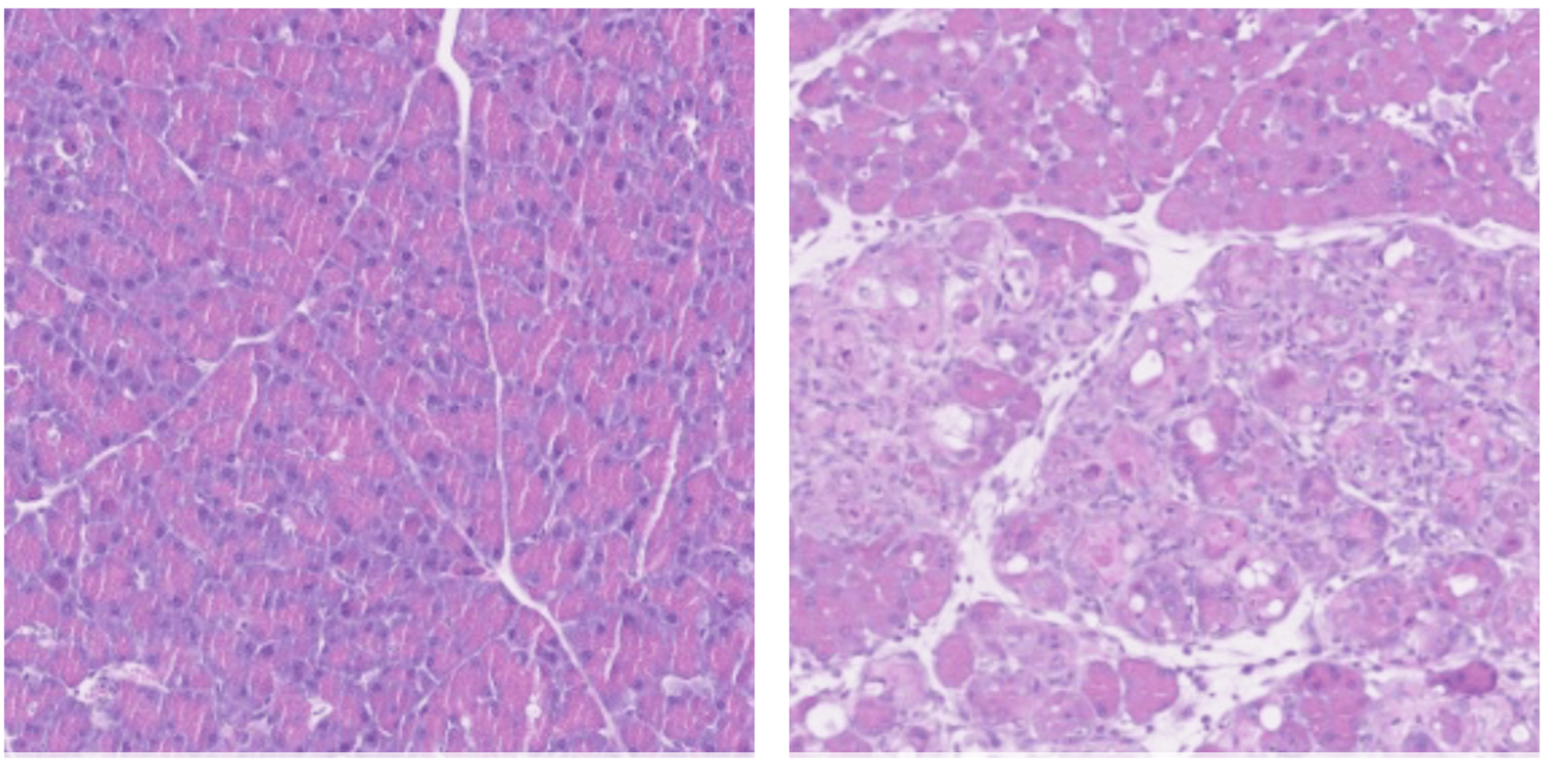 Tissue Fight Vitamin B12 helps reprogram cells to heal tissue & fight chron ...