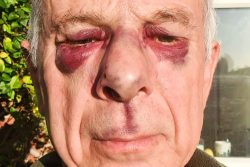 Police drop inquiry after man assaulted removing flags